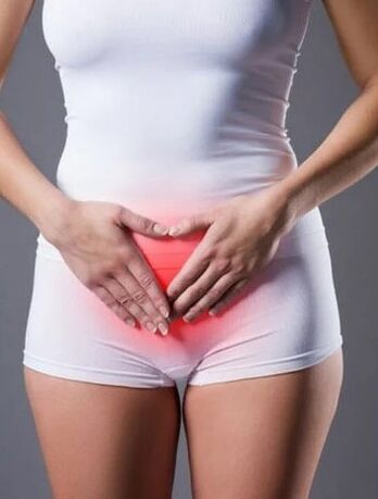 Cystitis
